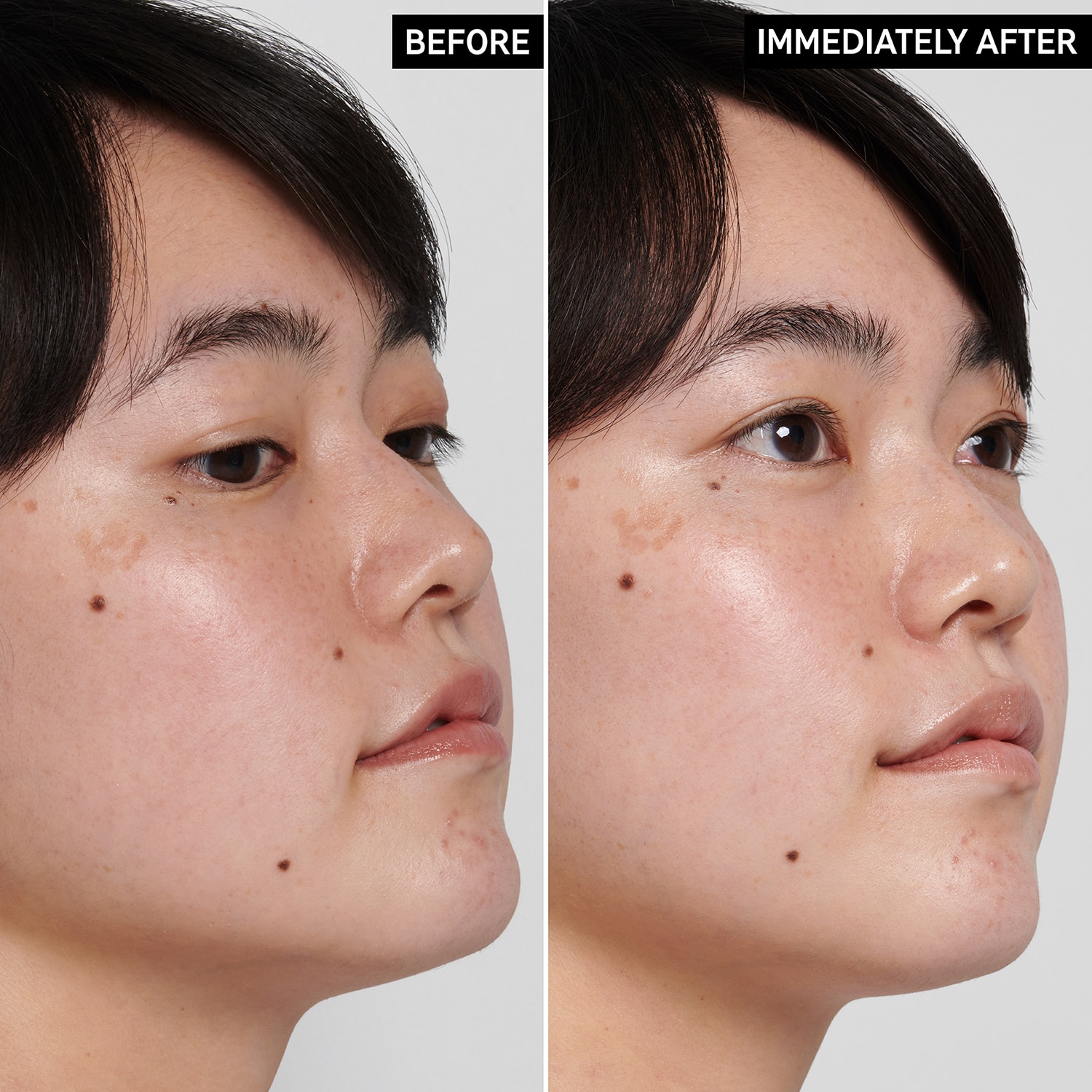 HYALURONIC ACID CLEANSER (LIMPIADOR FACIAL)